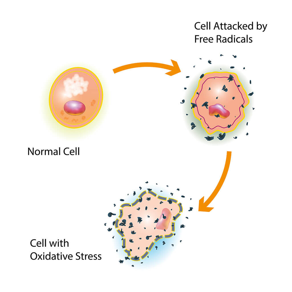 Oxidative stress can improve with superfoods. 