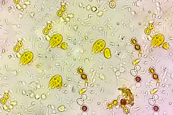 Giardia under a microscope.